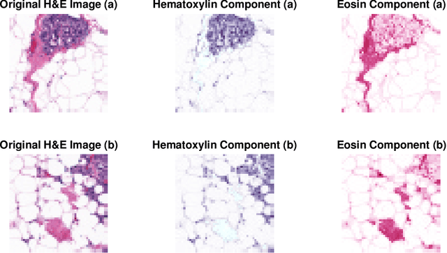 Figure 3 for A Compact Representation of Histopathology Images using Digital Stain Separation & Frequency-Based Encoded Local Projections