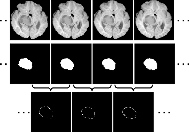 Figure 1 for Inter-slice Context Residual Learning for 3D Medical Image Segmentation