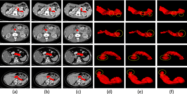 Figure 4 for Inter-slice Context Residual Learning for 3D Medical Image Segmentation