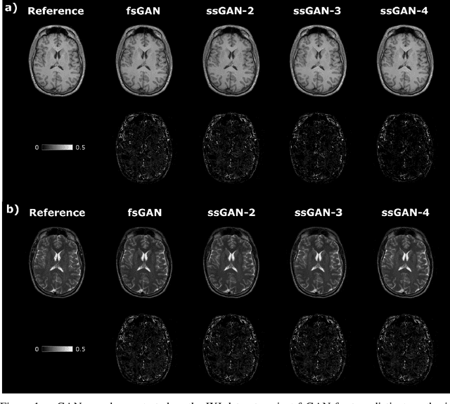 Figure 1 for Semi-Supervised Learning of Mutually Accelerated Multi-Contrast MRI Synthesis without Fully-Sampled Ground-Truths