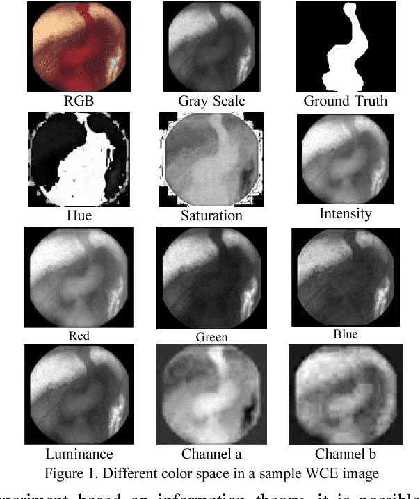 Figure 1 for Segmentation of Bleeding Regions in Wireless Capsule Endoscopy for Detection of Informative Frames