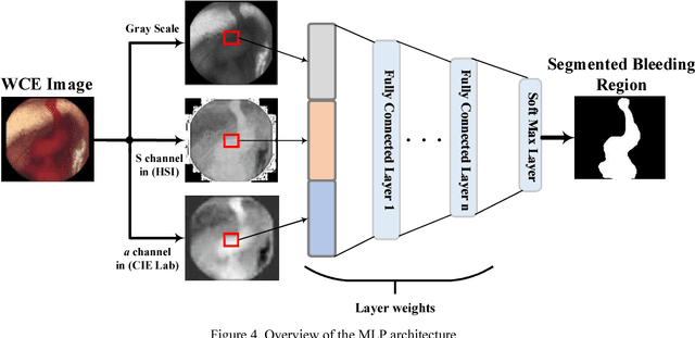 Figure 4 for Segmentation of Bleeding Regions in Wireless Capsule Endoscopy for Detection of Informative Frames