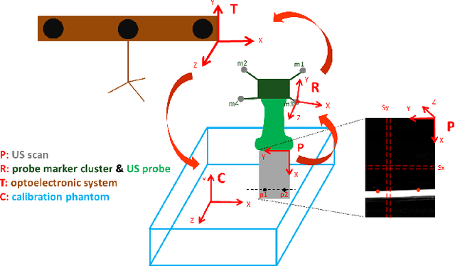 Figure 1 for Py3DFreeHandUS: a library for voxel-array reconstruction using Ultrasonography and attitude sensors
