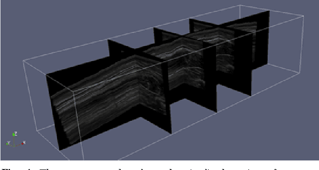 Figure 4 for Py3DFreeHandUS: a library for voxel-array reconstruction using Ultrasonography and attitude sensors