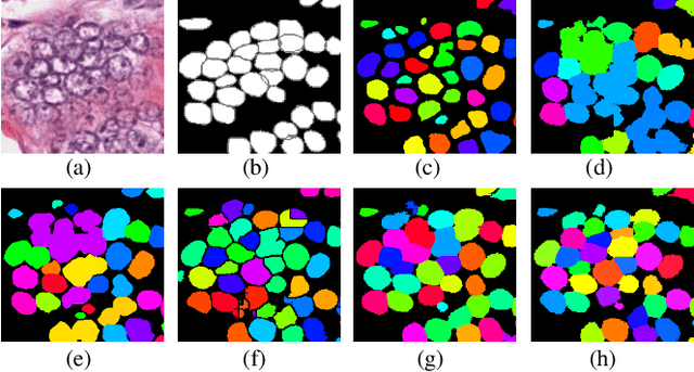 Figure 1 for Bending Loss Regularized Network for Nuclei Segmentation in Histopathology Images
