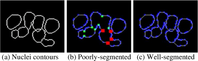 Figure 4 for Bending Loss Regularized Network for Nuclei Segmentation in Histopathology Images