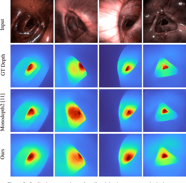 Figure 3 for C$^3$Fusion: Consistent Contrastive Colon Fusion, Towards Deep SLAM in Colonoscopy