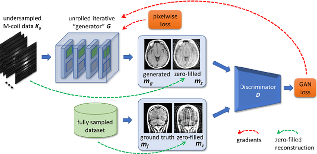 Figure 1 for Conditional WGANs with Adaptive Gradient Balancing for Sparse MRI Reconstruction