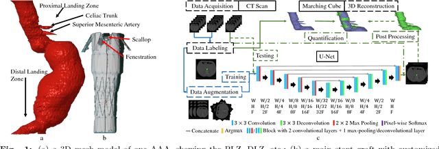 Figure 1 for Abdominal Aortic Aneurysm Segmentation with a Small Number of Training Subjects