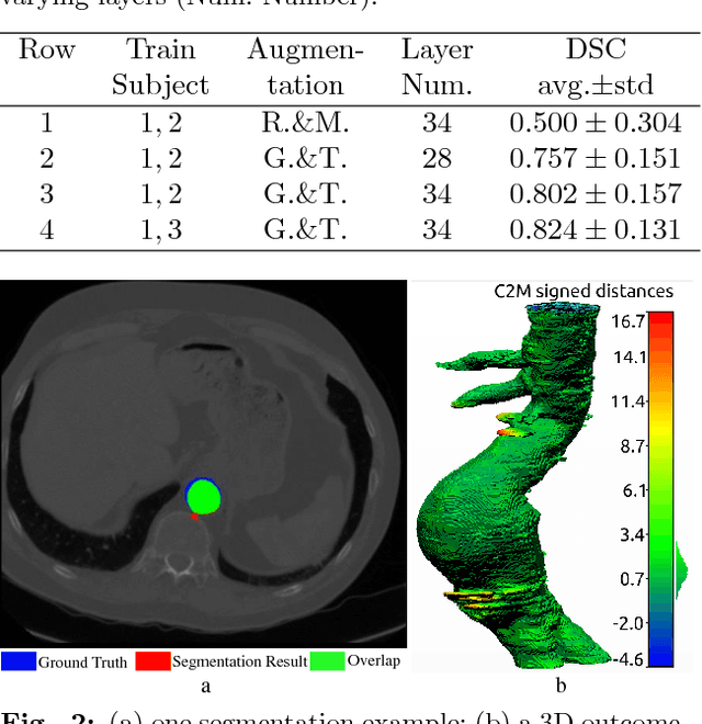 Figure 2 for Abdominal Aortic Aneurysm Segmentation with a Small Number of Training Subjects