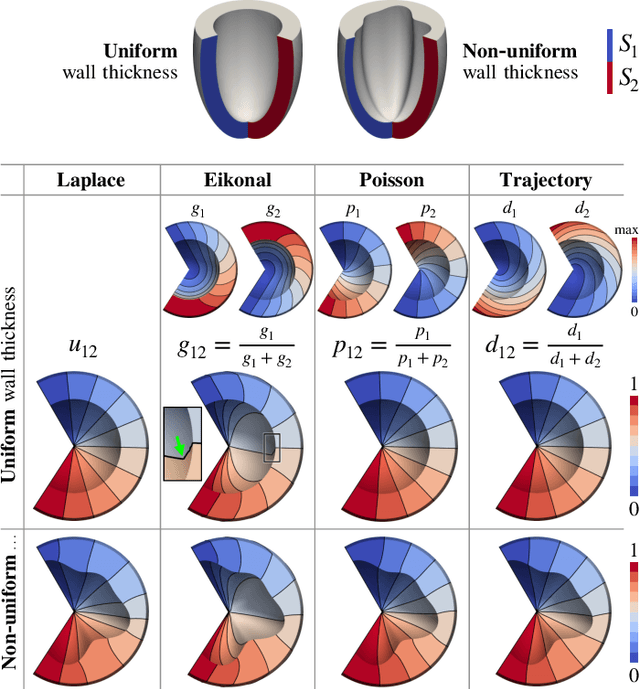 Figure 3 for Cobiveco: Consistent biventricular coordinates for precise and intuitive description of position in the heart -- with MATLAB implementation