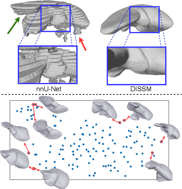 Figure 1 for Deep Implicit Statistical Shape Models for 3D Medical Image Delineation