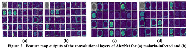 Figure 3 for Deep CNN frameworks comparison for malaria diagnosis
