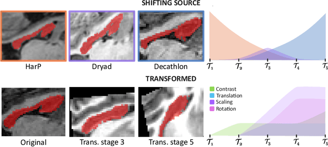 Figure 3 for Task-agnostic Continual Hippocampus Segmentation for Smooth Population Shifts