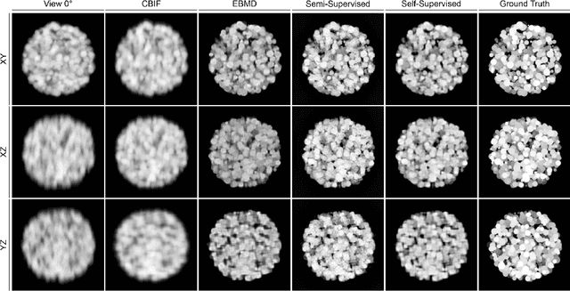 Figure 3 for Semi- and Self-Supervised Multi-View Fusion of 3D Microscopy Images using Generative Adversarial Networks