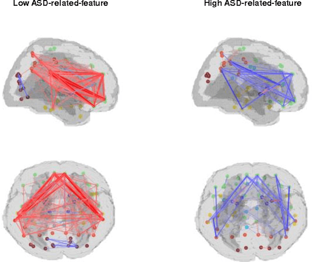 Figure 4 for Functional connectivity patterns of autism spectrum disorder identified by deep feature learning