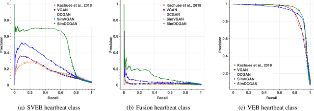 Figure 3 for SimGANs: Simulator-Based Generative Adversarial Networks for ECG Synthesis to Improve Deep ECG Classification