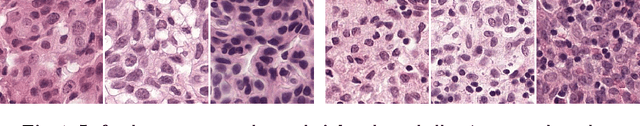 Figure 1 for Detecting Cancer Metastases on Gigapixel Pathology Images
