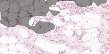 Figure 3 for Detecting Cancer Metastases on Gigapixel Pathology Images