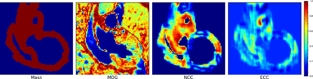 Figure 3 for MvMM-RegNet: A new image registration framework based on multivariate mixture model and neural network estimation