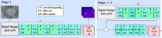 Figure 1 for X-ray-transform Invariant Anatomical Landmark Detection for Pelvic Trauma Surgery