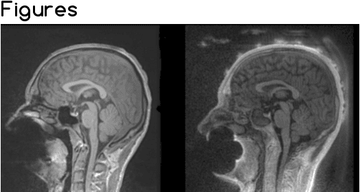 Figure 1 for Automatic Electrodes Detection during simultaneous EEG/fMRI acquisition