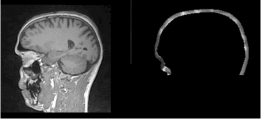 Figure 2 for Automatic Electrodes Detection during simultaneous EEG/fMRI acquisition
