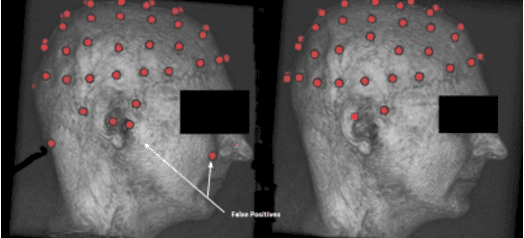 Figure 3 for Automatic Electrodes Detection during simultaneous EEG/fMRI acquisition