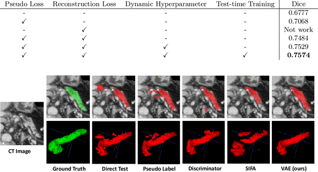 Figure 2 for Unsupervised Domain Adaptation through Shape Modeling for Medical Image Segmentation