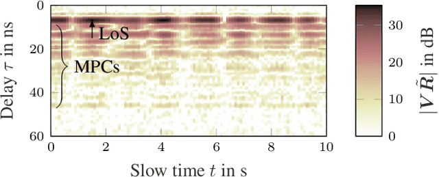 Figure 1 for Variational Message Passing-based Respiratory Motion Estimation and Detection Using Radar Signals