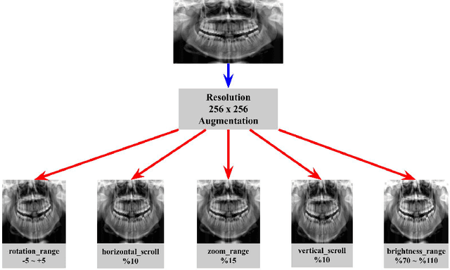Figure 3 for Forensic Dental Age Estimation Using Modified Deep Learning Neural Network