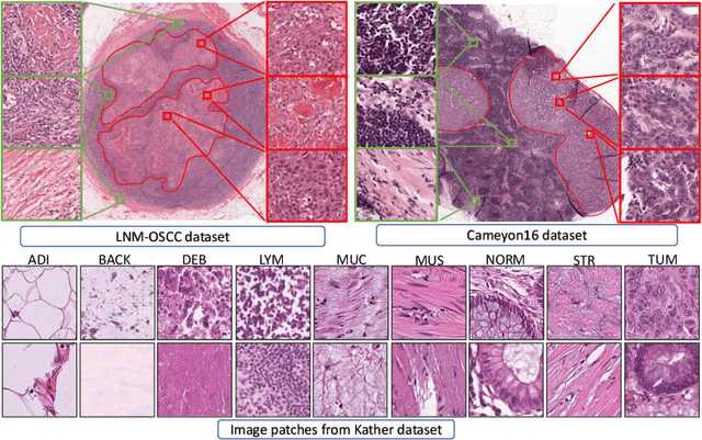 Figure 3 for Self-Path: Self-supervision for Classification of Pathology Images with Limited Annotations