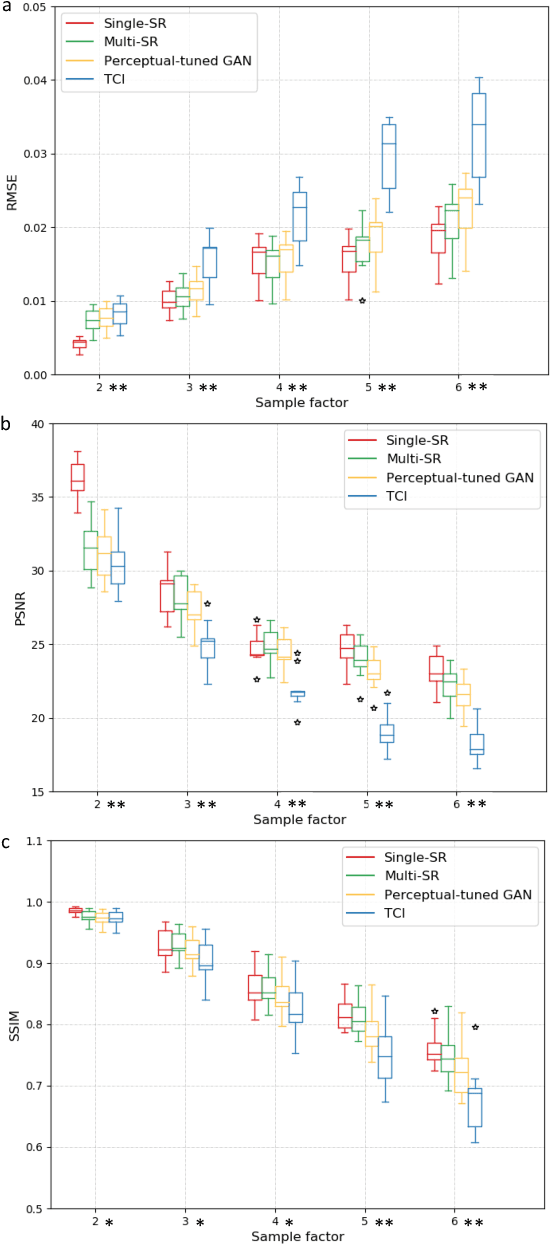 Figure 2 for SOUP-GAN: Super-Resolution MRI Using Generative Adversarial Networks