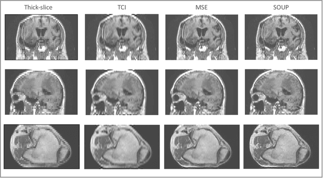 Figure 3 for SOUP-GAN: Super-Resolution MRI Using Generative Adversarial Networks