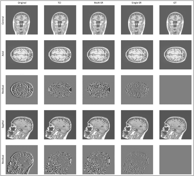 Figure 4 for SOUP-GAN: Super-Resolution MRI Using Generative Adversarial Networks