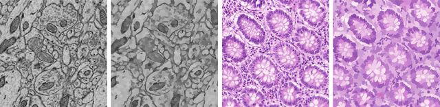 Figure 1 for SPDA: Superpixel-based Data Augmentation for Biomedical Image Segmentation