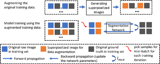 Figure 3 for SPDA: Superpixel-based Data Augmentation for Biomedical Image Segmentation