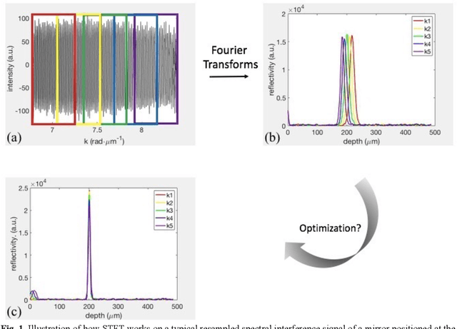 Figure 1 for Systematic dispersion compensation for spectral domain optical coherence tomography using time-frequency analysis and iterative optimization for iridocorneal angle imaging