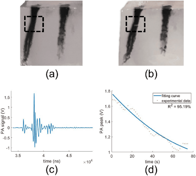Figure 4 for Photoacoustic-monitored laser treatment for tattoo removal: a feasibility study