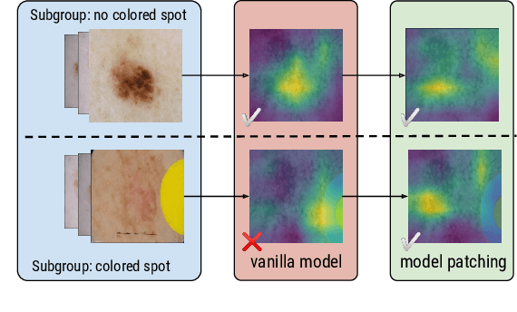 Figure 1 for Model Patching: Closing the Subgroup Performance Gap with Data Augmentation