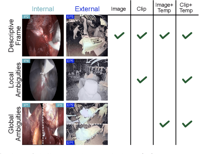 Figure 1 for Surgical Workflow Recognition: from Analysis of Challenges to Architectural Study