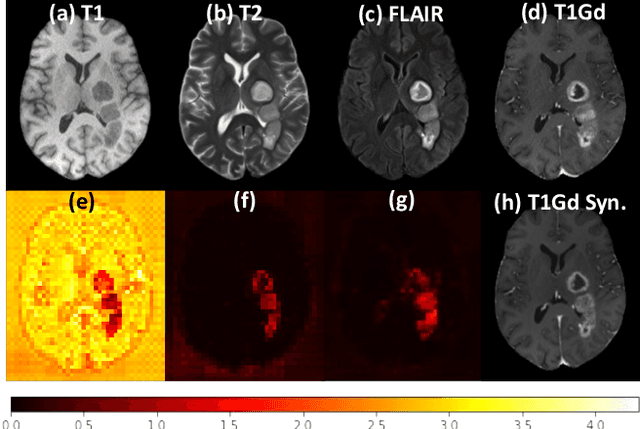 Figure 2 for One Model to Synthesize Them All: Multi-contrast Multi-scale Transformer for Missing Data Imputation
