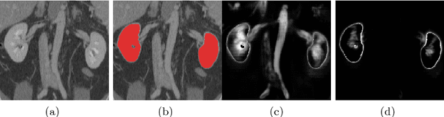 Figure 1 for Boosted Training of Convolutional Neural Networks for Multi-Class Segmentation