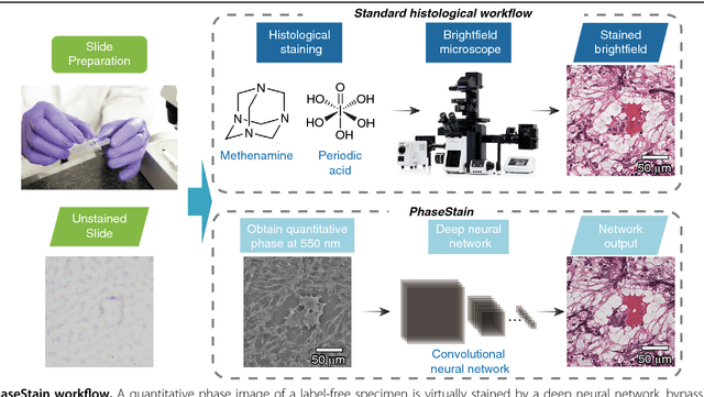 Figure 1 for PhaseStain: Digital staining of label-free quantitative phase microscopy images using deep learning