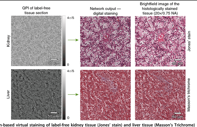 Figure 4 for PhaseStain: Digital staining of label-free quantitative phase microscopy images using deep learning