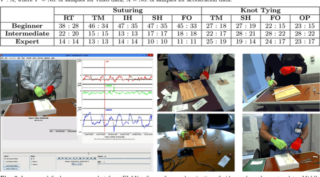 Figure 2 for Video and Accelerometer-Based Motion Analysis for Automated Surgical Skills Assessment