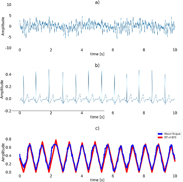 Figure 2 for End-to-End Deep Learning for Reliable Cardiac Activity Monitoring using Seismocardiograms