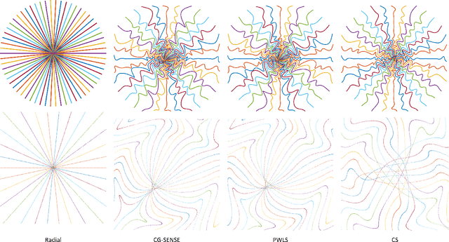 Figure 3 for Efficient approximation of Jacobian matrices involving a non-uniform fast Fourier transform (NUFFT)