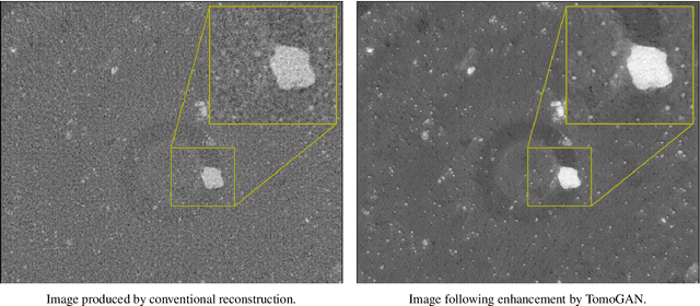 Figure 2 for TomoGAN: Low-Dose X-Ray Tomography with Generative Adversarial Networks