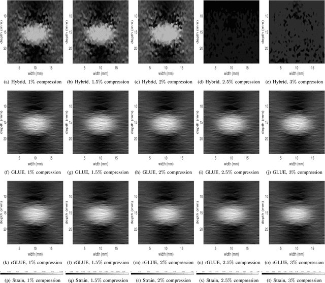 Figure 2 for Incorporating Gradient Similarity for Robust Time Delay Estimation in Ultrasound Elastography